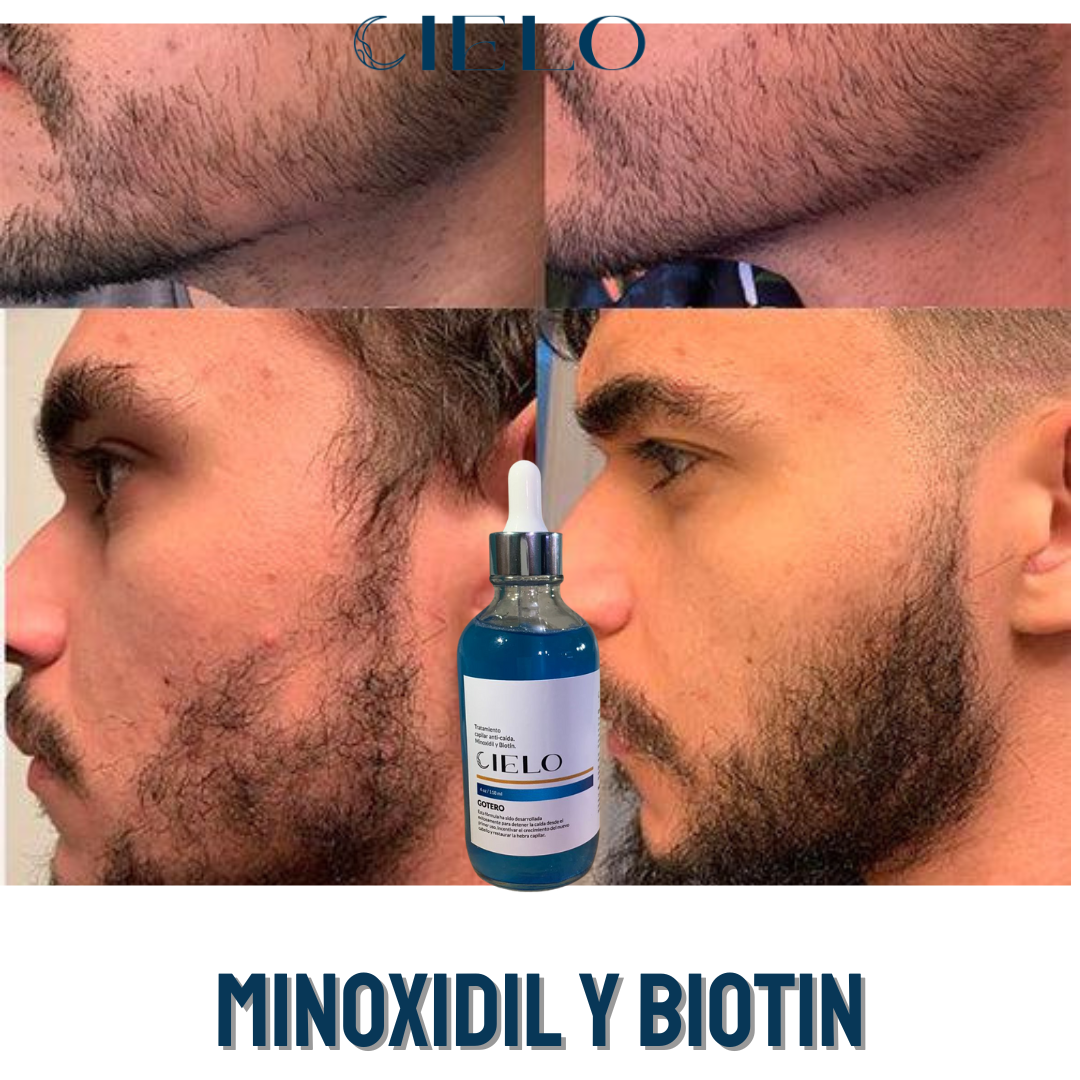 Gotero Cielo Minoxidil y Biotin- Anticaída y Crecimiento del cabello y Barba